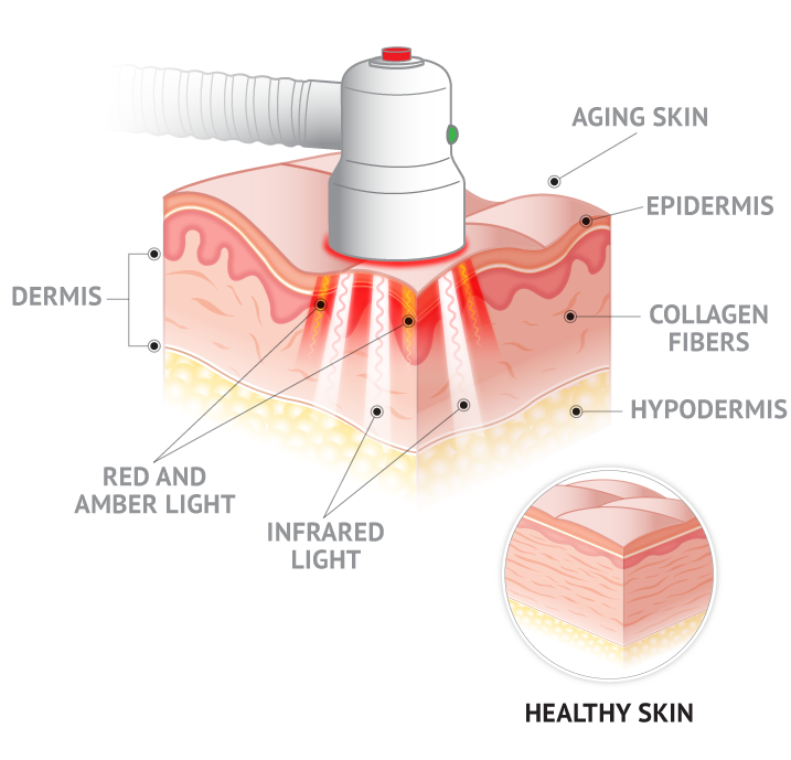 Quasar MD Plus