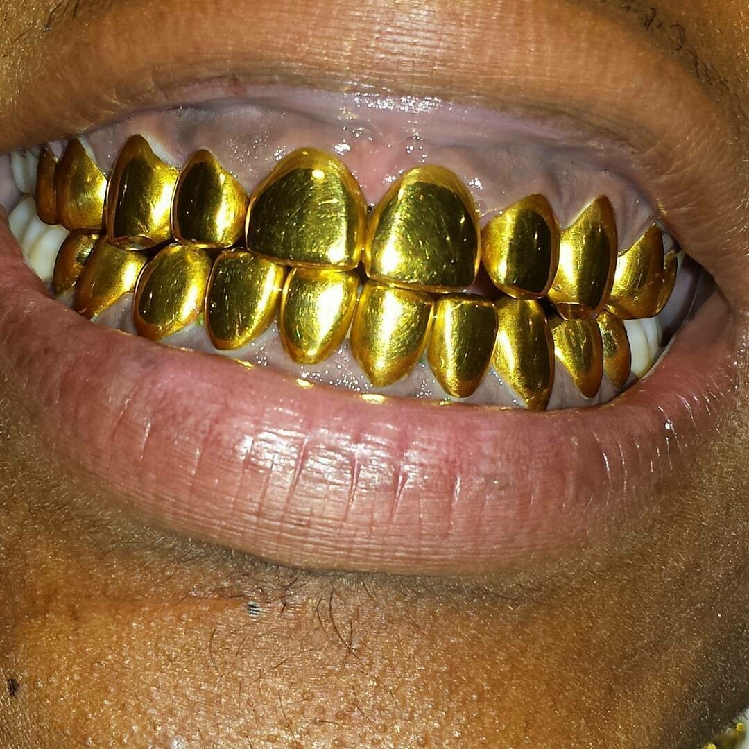 Permanent Gold Teeth In Jacksonville Florida TeethWalls