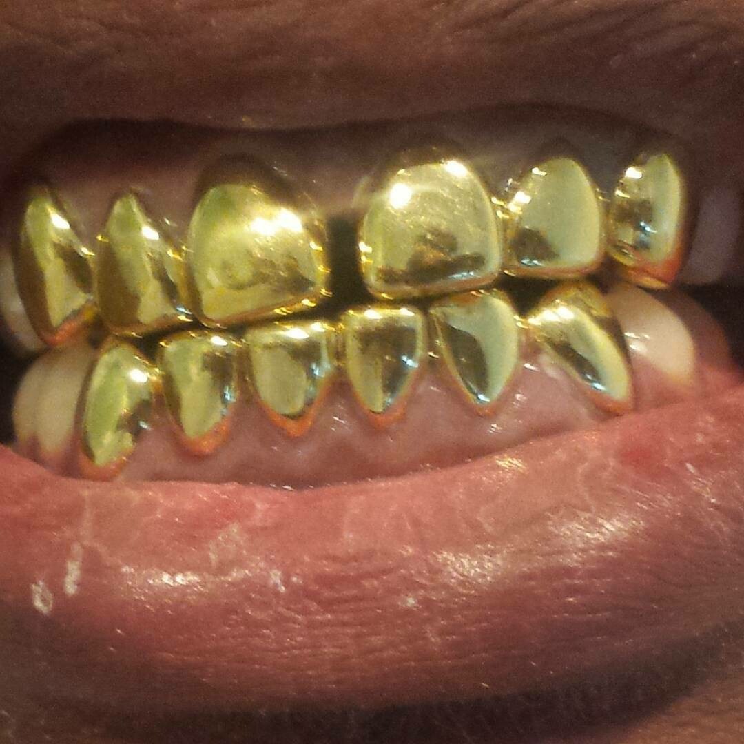 Best Permanent Gold Teeth In Florida TeethWalls