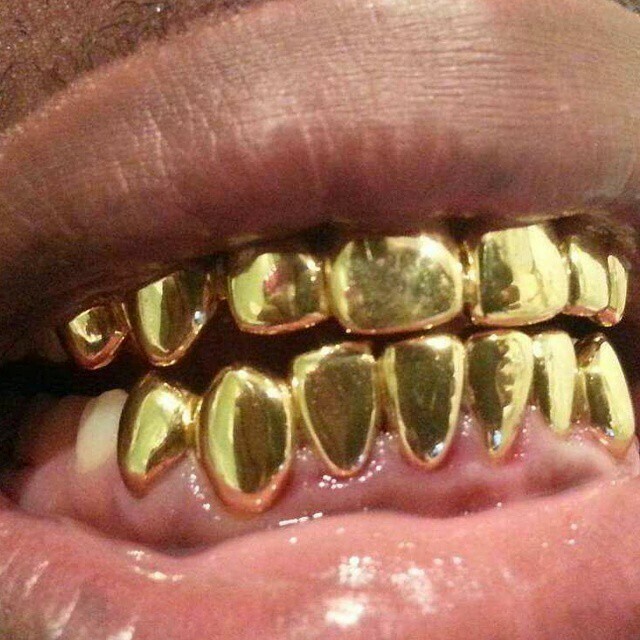 Best Permanent Gold Teeth In Florida - Teeth Poster