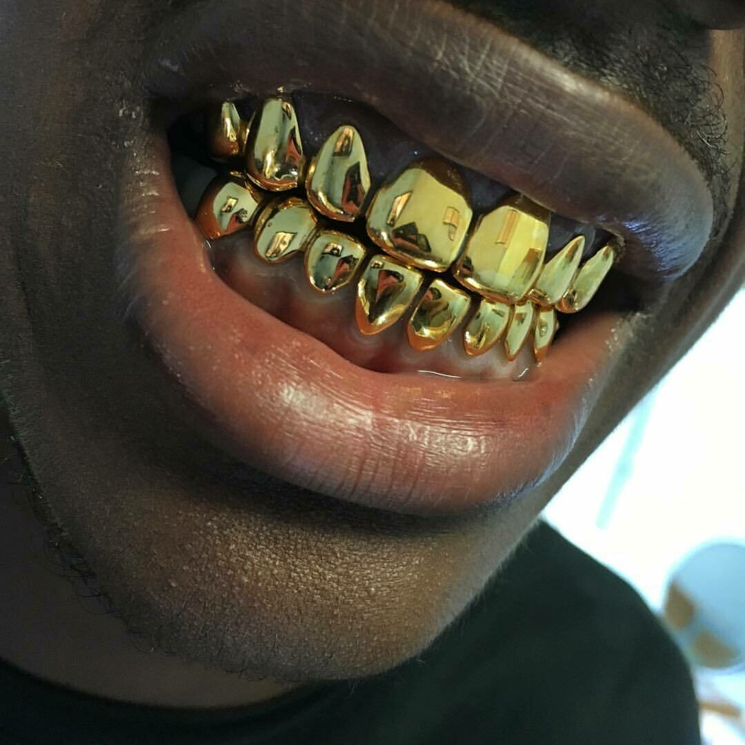 NonPrecious Gold Alloy (40 Per Tooth)