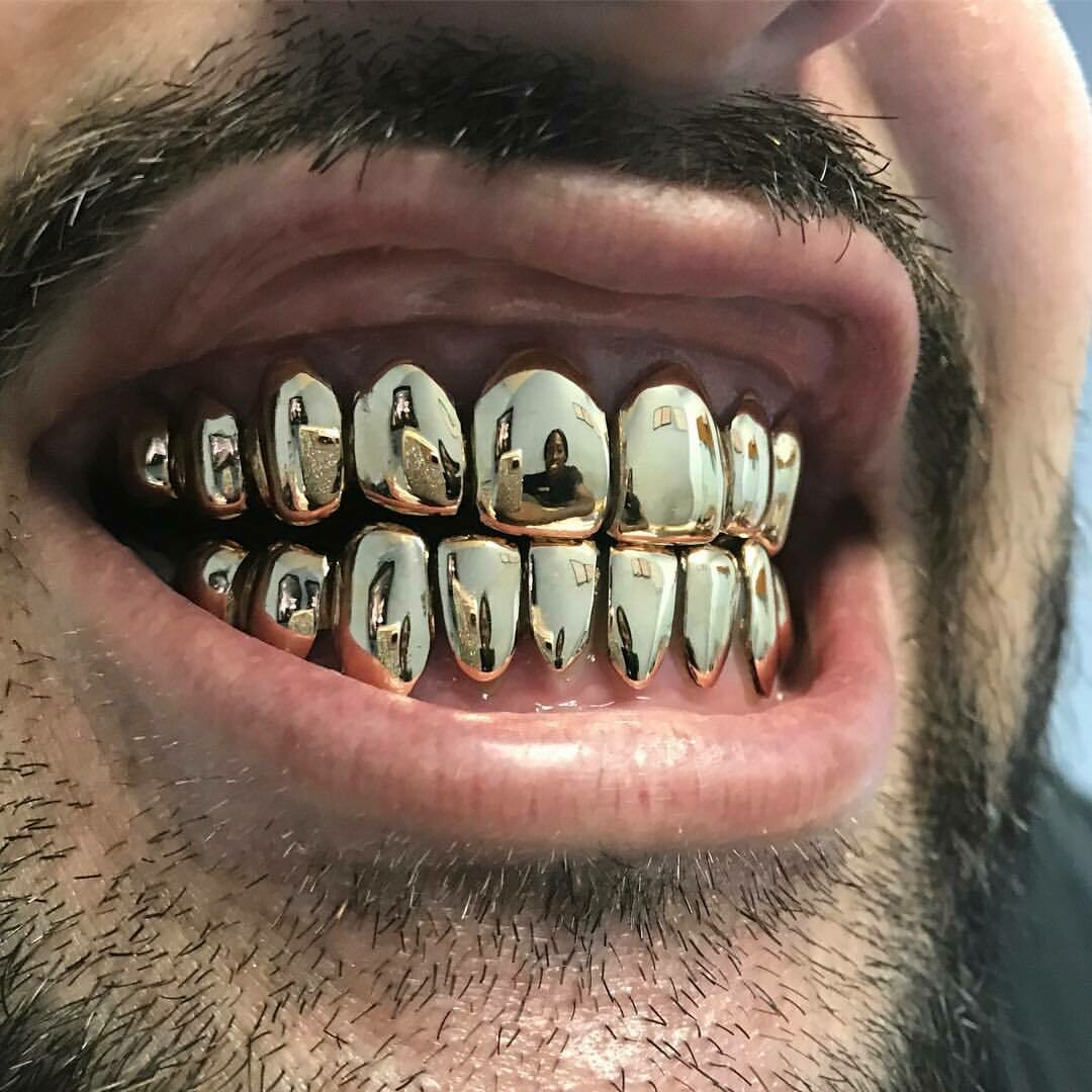 14 Karat Gold Grillz ($100 Per Tooth)