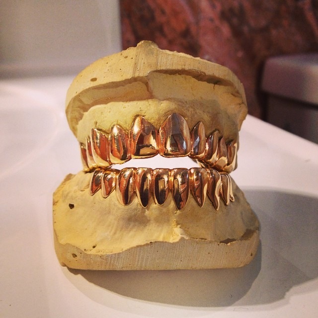 18 Karat Gold Grillz (130 per tooth)