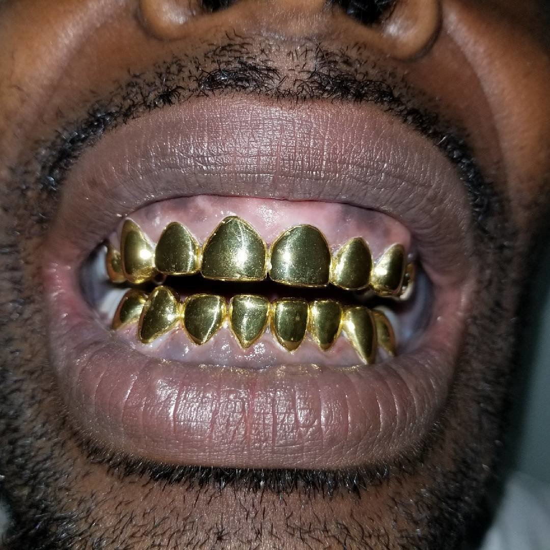 How Much Does 2 Gold Teeth Cost TeethWalls How Much Does 2 Gold Teeth Cost TeethWalls