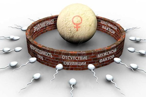 Запись вебинара №2 Бесплодие: современные методы лечения 00035