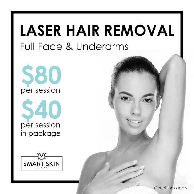 Female Laser Hair Removal - Full Face & Underarms. | Laser ...