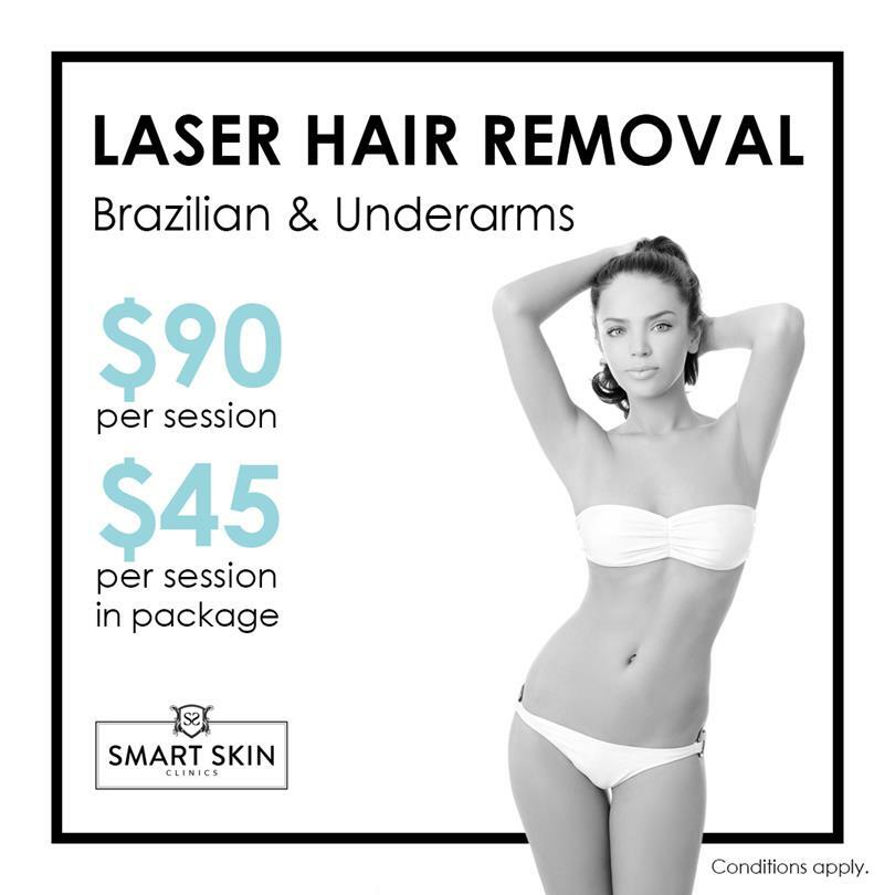 Female Laser Hair Removal - Brazilian & Underarms. | Laser ...