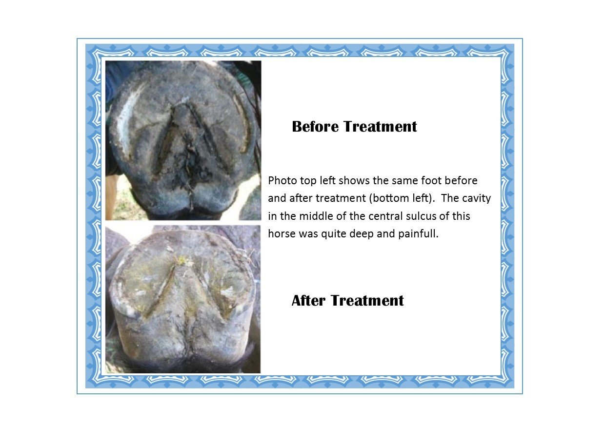 Before and After treatment with ThrushEze