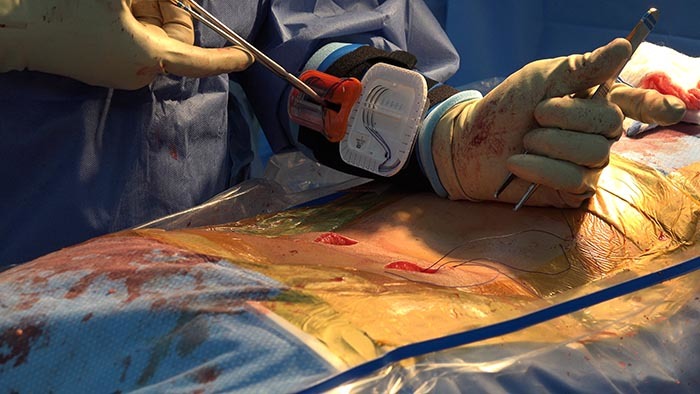 Large Needle Barrier Kit