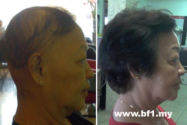 Control Hair Loss And Promoting Hair Growth within 7 days, money back guarantee. Hair Growth Home Care Set is for 30-45 days usage to testify our Hair Growth Result within 7 days. It helps to resolved more then 90% hair loss and scalp problems and perform new hair growth within 7 days of usage follow our direction. http://shop.bf-1.com/index.php?main_page=index&cPath=4