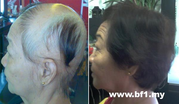 Control Hair Loss And Promoting Hair Growth within 7 days, money back guarantee. Hair Growth Home Care Set is for 30-45 days usage to testify our Hair Growth Result within 7 days. It helps to resolved more then 90% hair loss and scalp problems and perform new hair growth within 7 days of usage follow our direction. http://shop.bf-1.com/index.php?main_page=index&cPath=4