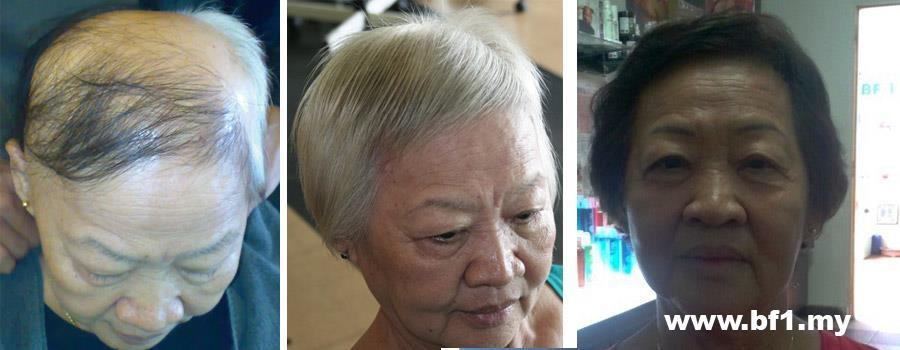 Control Hair Loss And Promoting Hair Growth within 7 days, money back guarantee. Hair Growth Home Care Set is for 30-45 days usage to testify our Hair Growth Result within 7 days. It helps to resolved more then 90% hair loss and scalp problems and perform new hair growth within 7 days of usage follow our direction. http://shop.bf-1.com/index.php?main_page=index&cPath=4