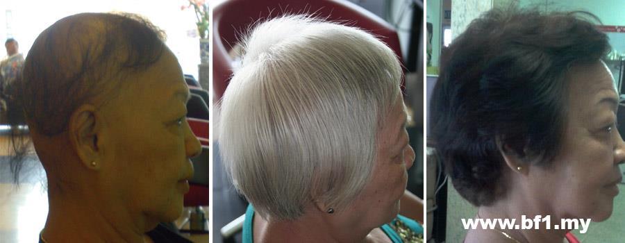 Control Hair Loss And Promoting Hair Growth within 7 days, money back guarantee. Hair Growth Home Care Set is for 30-45 days usage to testify our Hair Growth Result within 7 days. It helps to resolved more then 90% hair loss and scalp problems and perform new hair growth within 7 days of usage follow our direction. http://shop.bf-1.com/index.php?main_page=index&cPath=4