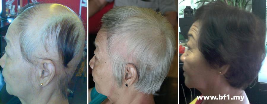 Control Hair Loss And Promoting Hair Growth within 7 days, money back guarantee. Hair Growth Home Care Set is for 30-45 days usage to testify our Hair Growth Result within 7 days. It helps to resolved more then 90% hair loss and scalp problems and perform new hair growth within 7 days of usage follow our direction. http://shop.bf-1.com/index.php?main_page=index&cPath=4