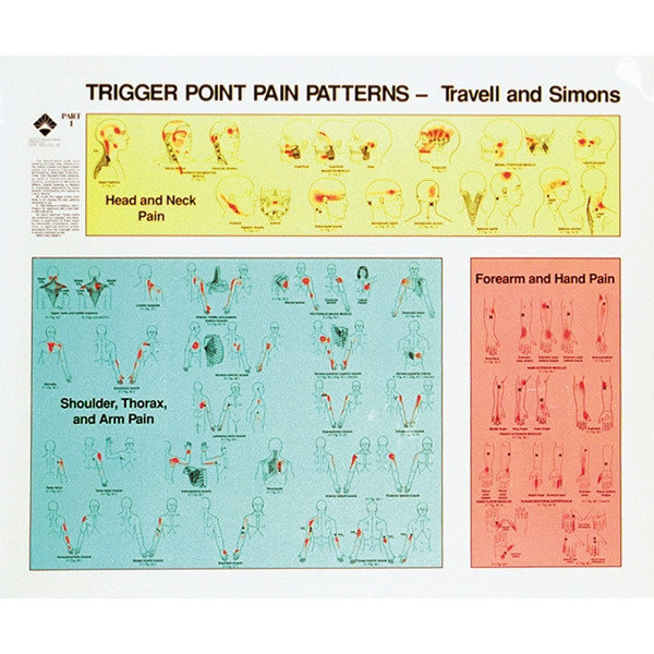 Trigger Punkt Planscher, Travell & Simon , 82 x 97 cm, set med 2 st