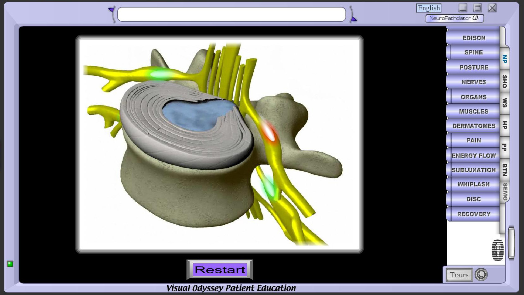Neuropatholator Touch - Bronze 03