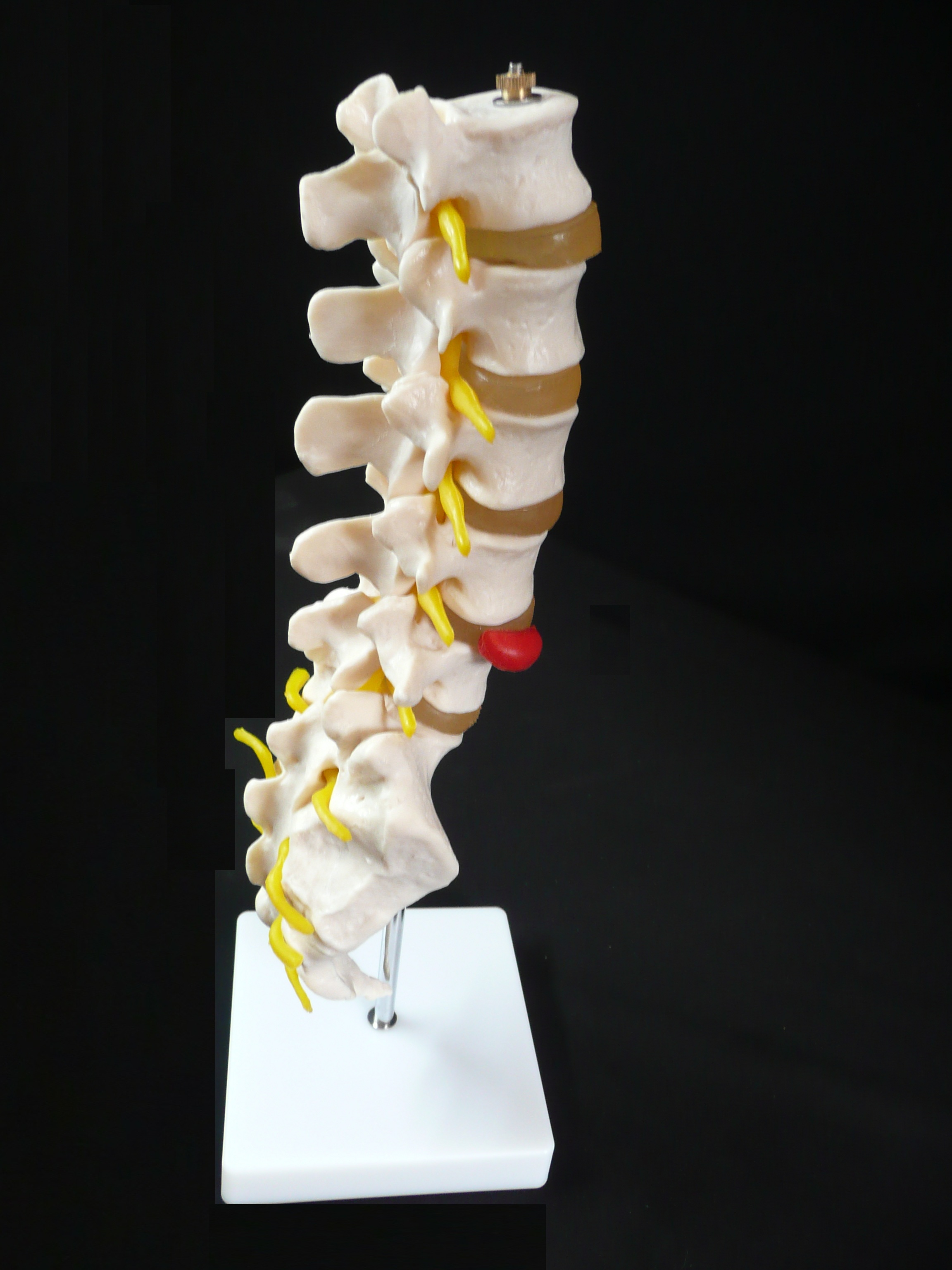 Lumbar Vertebrae Model