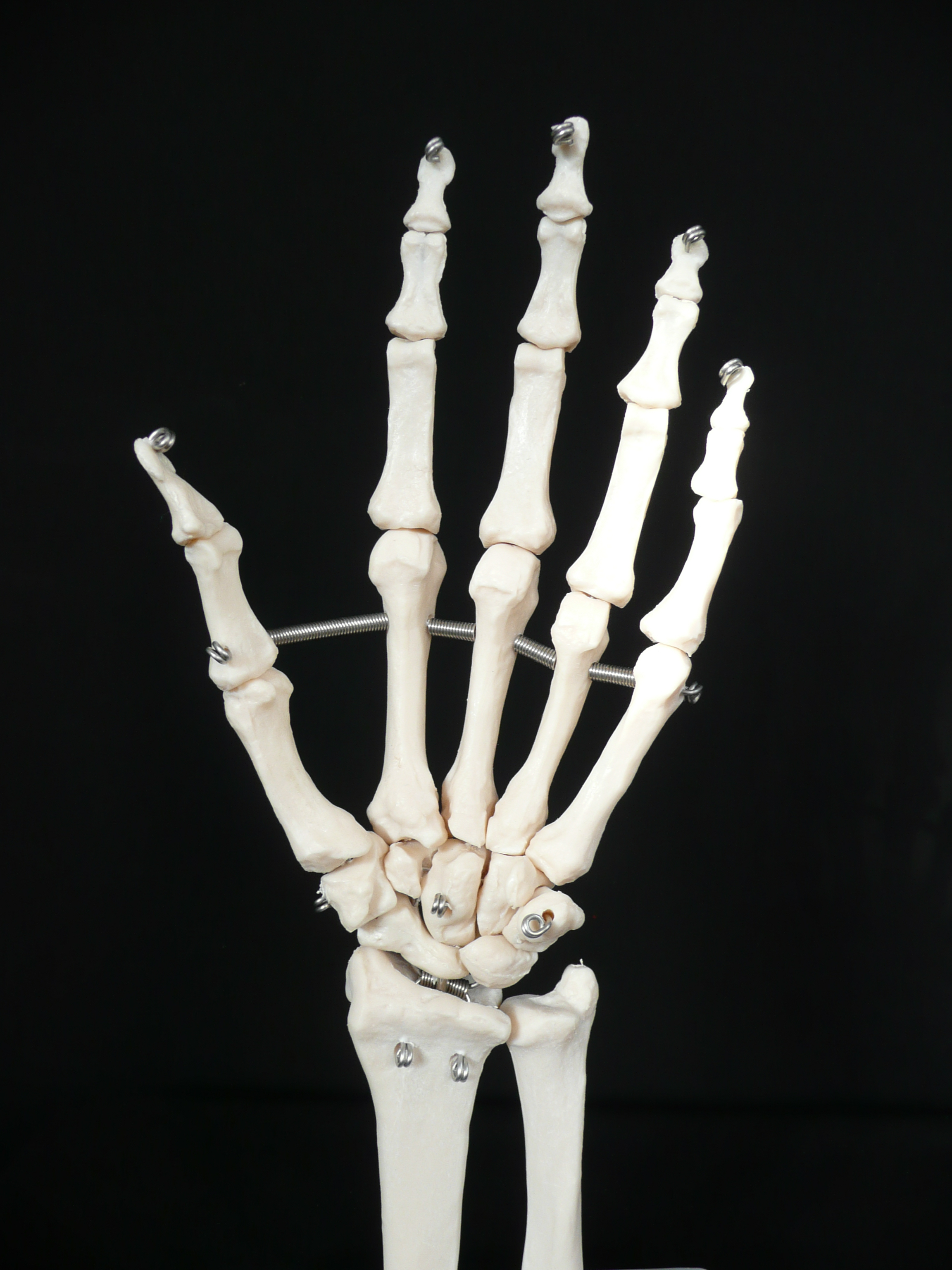 LifeSize Anatomical Human Hand/Wrist Joint Model Joints Products