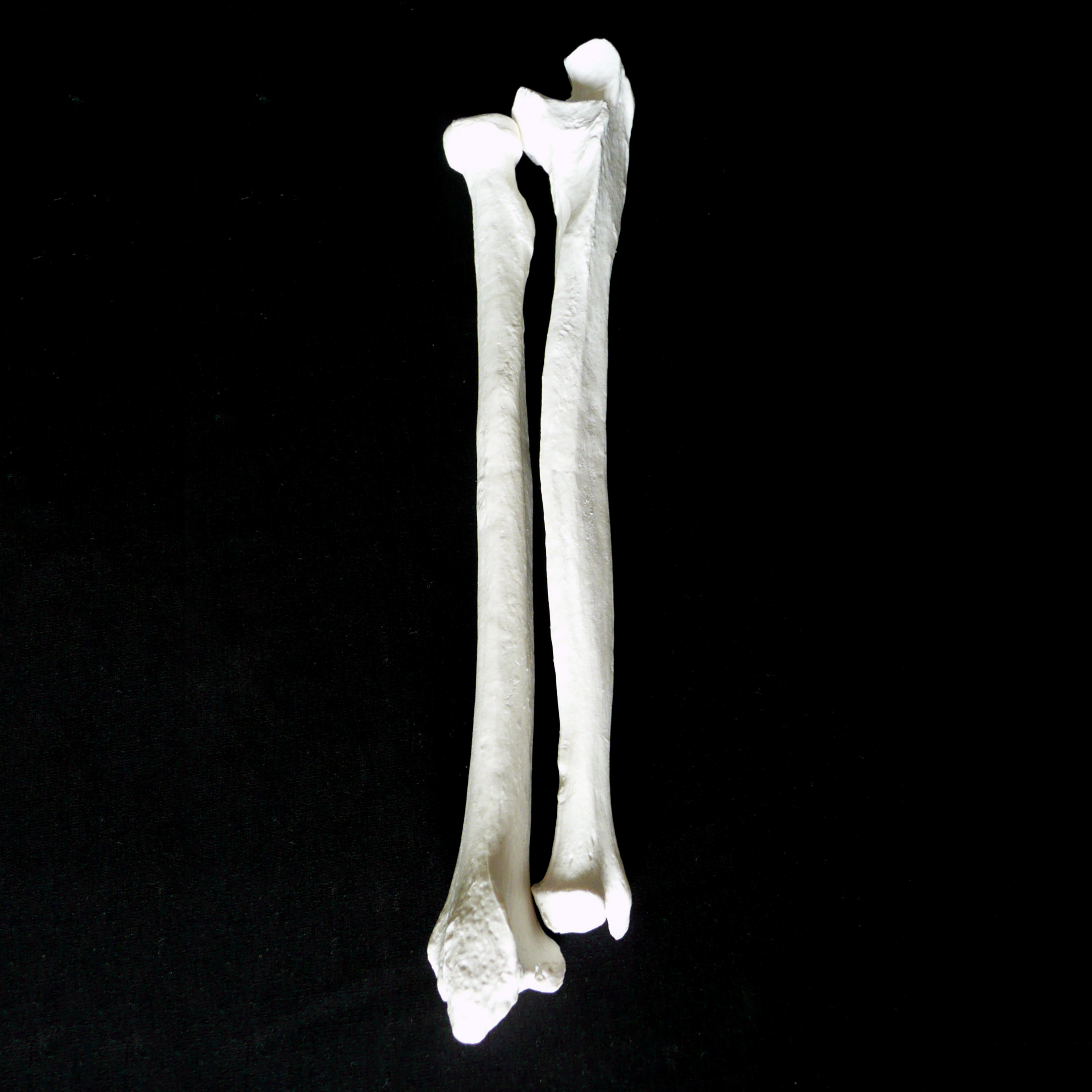 Anatomical Radius and Ulna Bone Models of the Human Arm | Skeletal ...