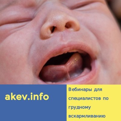 Короткие уздечки и грудное вскармливание 00104
